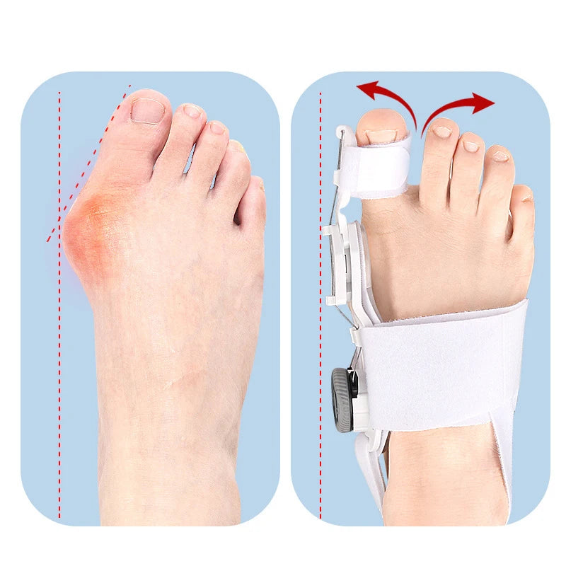 Bunion Corrector – Adjustable Toe Alignment Support for Daily Comfort - GleamPrism